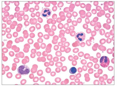 Blood smear showing erythrocytes, leukocytes, and platelets