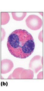 Eosinophil (granulocyte)