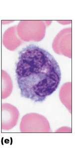 Monocyte (agranulocyte)