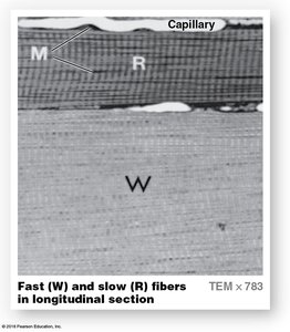 Electron micrograph of fast and slow muscle fibers