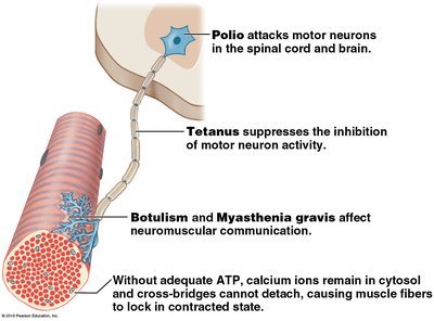 Diagram of polio, tetanus, botulism, and myasthenia gravis effects on muscle