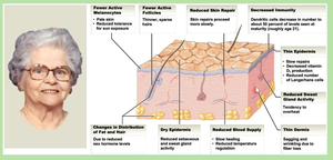 Diagram of skin showing age-related changes such as fewer active melanocytes, reduced repair, decreased immunity, and thinner epidermis