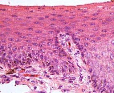 Stratified squamous epithelium