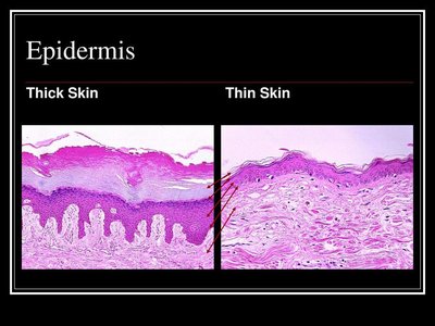 Comparison of thick and thin skin