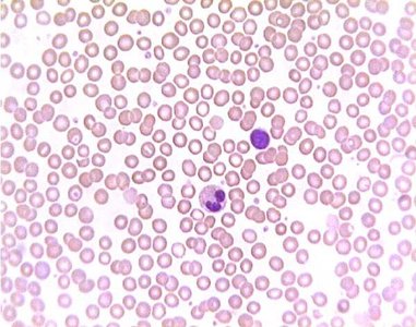Microscopic view of blood cells