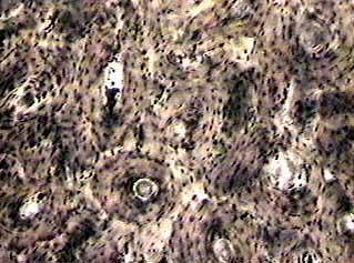 Microscopic view of bone tissue