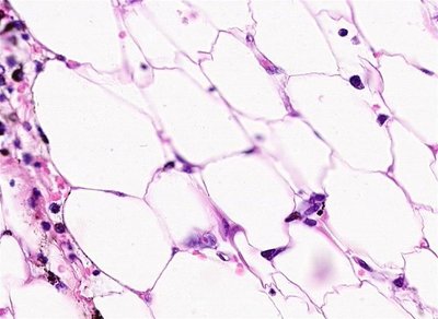 Microscopic view of adipose tissue