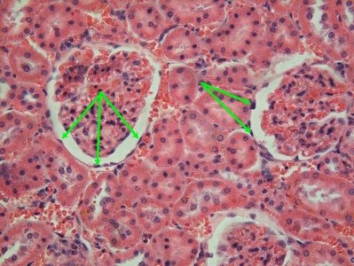 Simple squamous epithelium