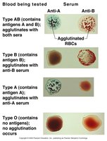 Blood typing reactions with anti-sera