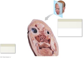 Sinuses of the skull