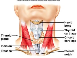 Tracheostomy clinical image