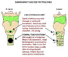Emergency access to trachea
