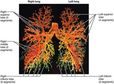 Cast of the bronchial tree