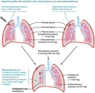 Pneumothorax and pressure changes