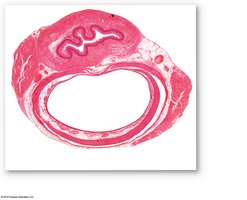 Histological cross-section of the trachea