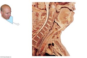 Anatomy of the pharynx and cervical vertebrae