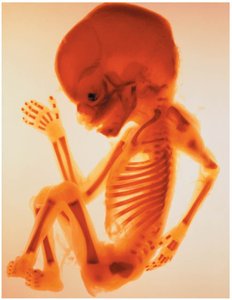 Fetal skeleton showing developing bones