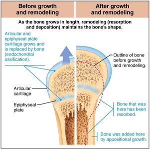 Bone growth and remodeling before and after