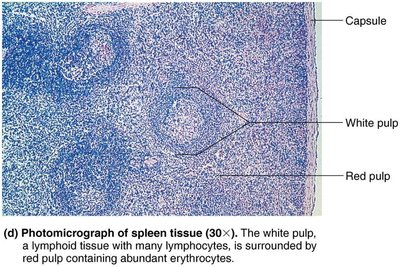 Photomicrograph of spleen tissue