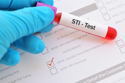 STI test tube and checklist