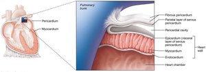 Heart wall and pericardium structure