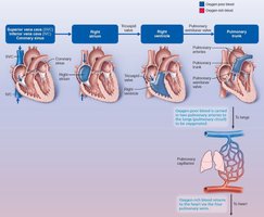 Right heart blood flow pathway