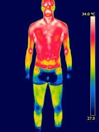 Thermal image showing heat loss in the human body