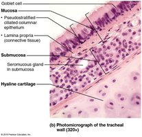 Photomicrograph of the tracheal wall showing mucosa, submucosa, and hyaline cartilage