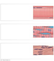 Histological comparison of muscle tissue types