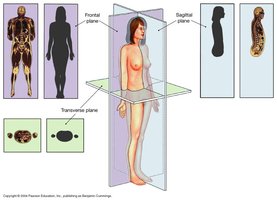 Sectional anatomy planes