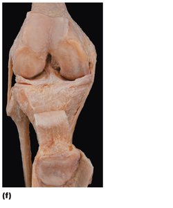 Photograph of an opened knee joint showing menisci and ligaments