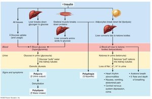 Consequences of Insulin Deficit (Diabetes Mellitus)