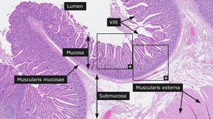Histological section of the intestinal wall showing mucosa, submucosa, muscularis externa, and villi