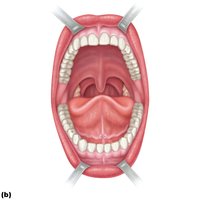 Anterior view of the oral cavity showing teeth, tongue, palate, and associated structures