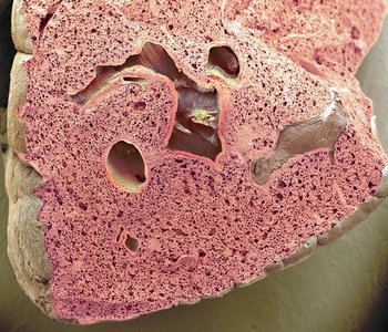 Photograph of lung tissue showing spongy structure