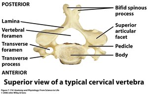 Superior view of a typical cervical vertebra