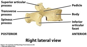 Right lateral view of a lumbar vertebra