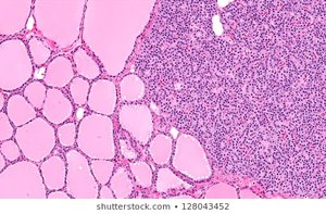 Histology of the thyroid and parathyroid gland