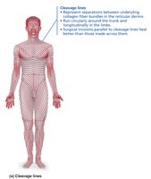 Cleavage lines in the reticular dermis