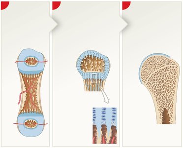 Diagram of bone growth at epiphyseal cartilages