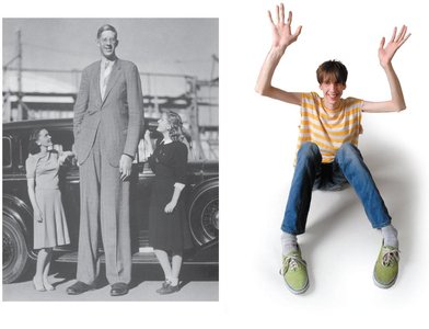 Images illustrating gigantism and Marfan syndrome