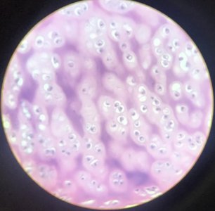 Hyaline cartilage under microscope