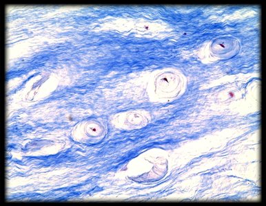 Fibrocartilage under microscope