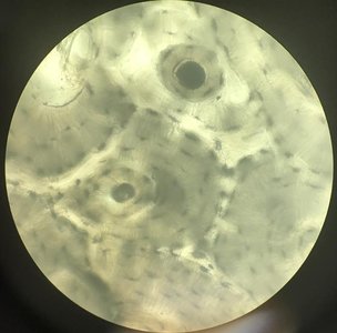 Compact bone under microscope