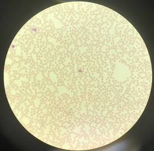 Blood under microscope