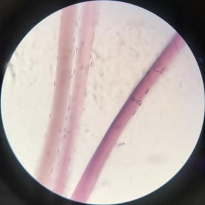 Skeletal muscle tissue under microscope