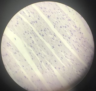 Cardiac muscle tissue under microscope