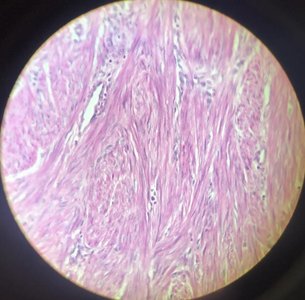 Smooth muscle tissue under microscope
