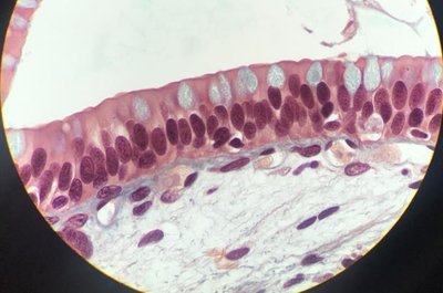 Simple columnar epithelium under microscope