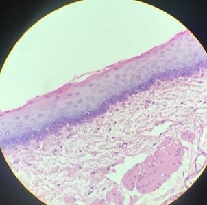 Stratified squamous epithelium under microscope